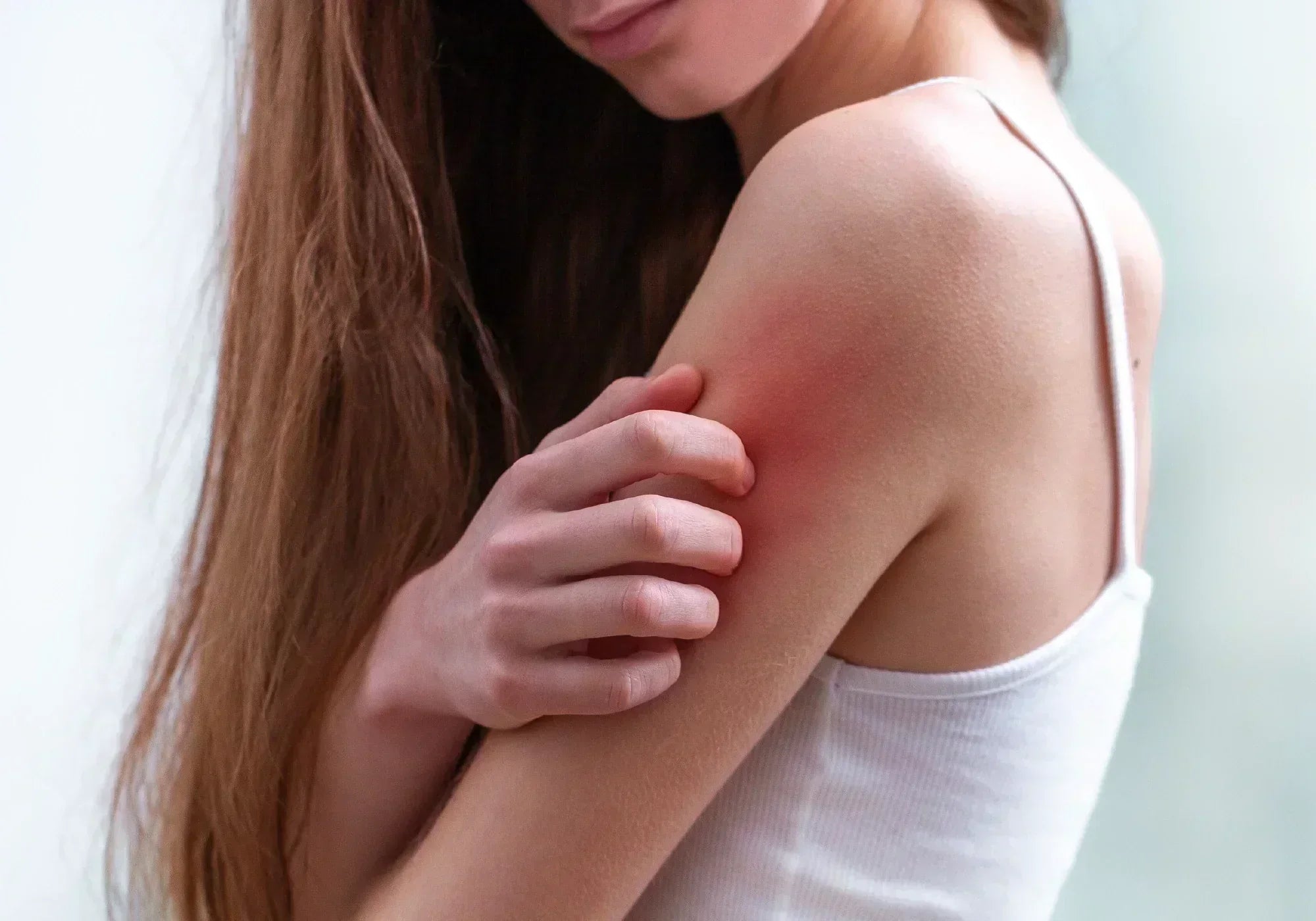 Как да си направите домашен лек против сърбеж