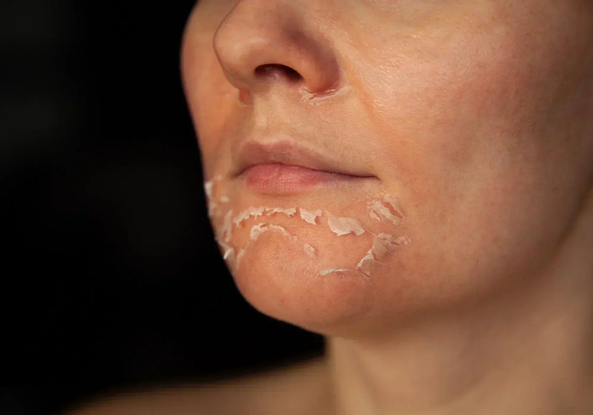 Липса на витамин А: 10 симптома на дефицит