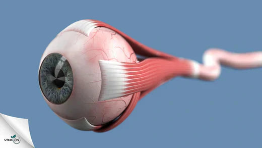 Всичко за неврит на зрителния нерв (оптичен неврит)